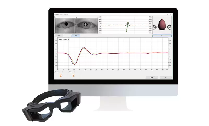 Introducing the VertiGoggles&trade; ZT-VNG-II: The Future of Vestibular Diagnostics