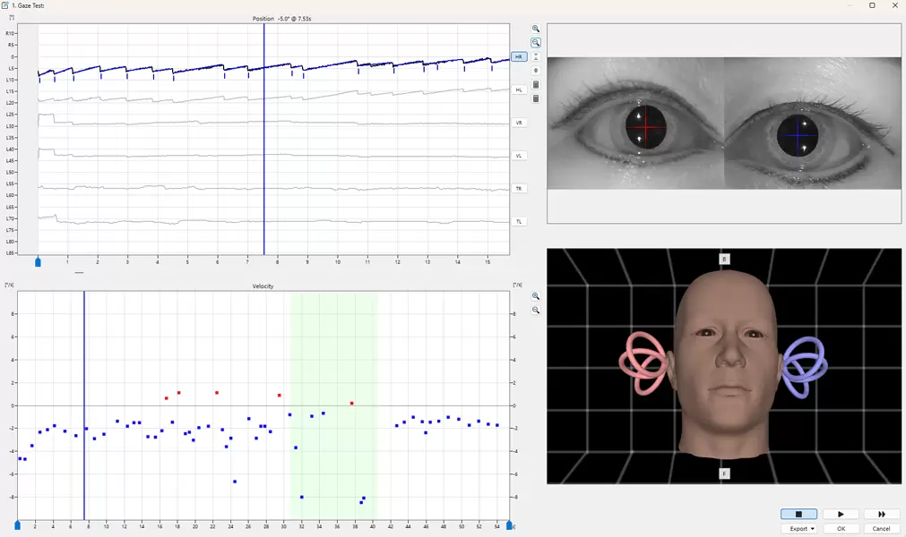Comprehensive & powerful balance assessment